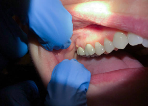 Best Emergency Denture Repair in Columbia, IL
