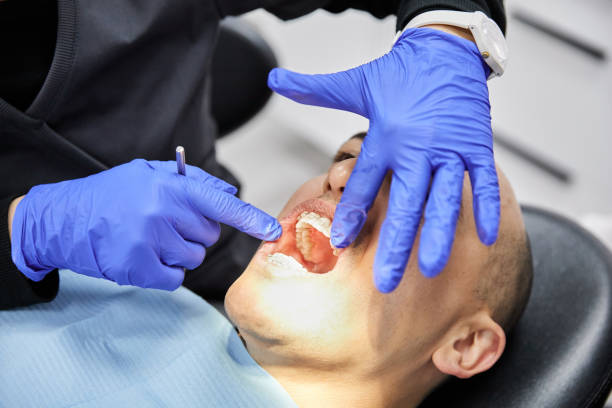 Best Urgent Care for Lost Fillings or Crowns in Columbia, IL
